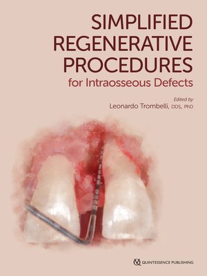 cover image of Simplified Regenerative Procedures for Intraosseous Defects